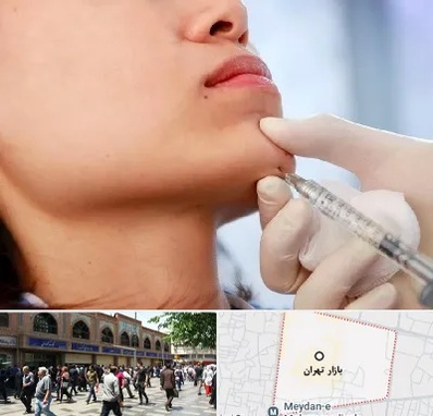 زاویه سازی صورت در بازار تهران