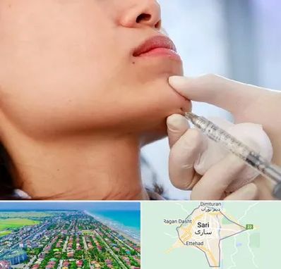 زاویه سازی صورت در ساری