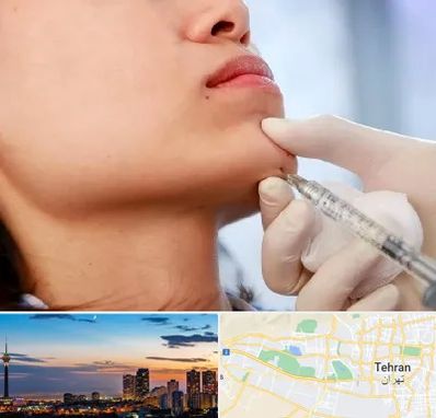 زاویه سازی صورت در غرب تهران 