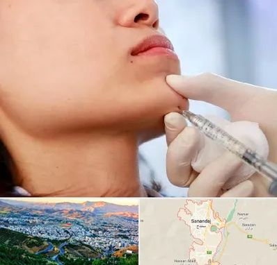 زاویه سازی صورت در سنندج