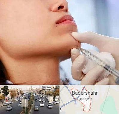زاویه سازی صورت در باقرشهر