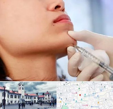 زاویه سازی صورت در میدان شهرداری رشت 