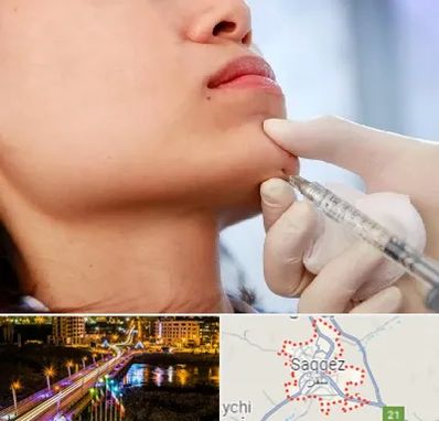 زاویه سازی صورت در سقز