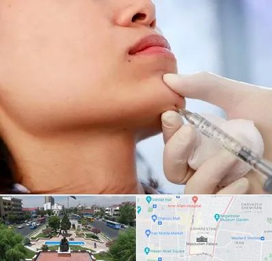 زاویه سازی صورت در بهارستان 