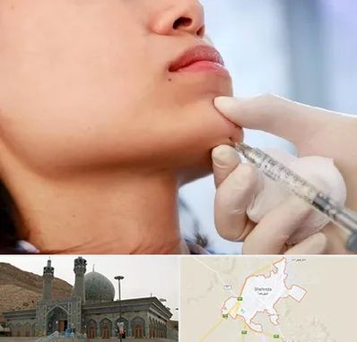 زاویه سازی صورت در شهرضا