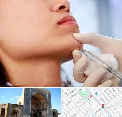 زاویه سازی صورت در مصلی مشهد