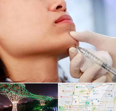 زاویه سازی صورت در منطقه 3 تهران 