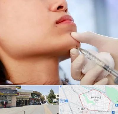 زاویه سازی صورت در پرواز تبریز