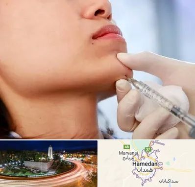 زاویه سازی صورت در همدان