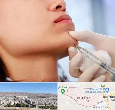 زاویه سازی صورت در شهرک گلستان شیراز 