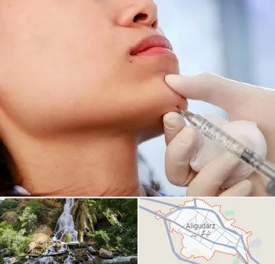 زاویه سازی صورت در الیگودرز