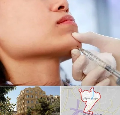 زاویه سازی صورت در مینی سیتی