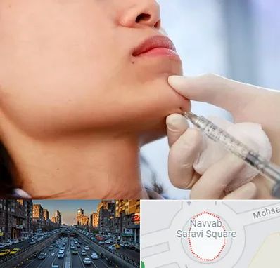 زاویه سازی صورت در نواب 