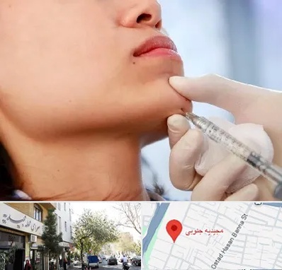 زاویه سازی صورت در مجیدیه جنوبی