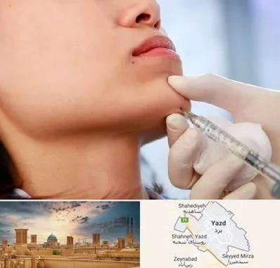 زاویه سازی صورت در یزد