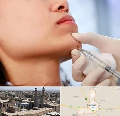 زاویه سازی صورت در سبزوار