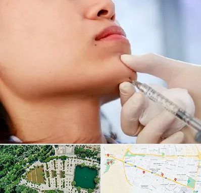 زاویه سازی صورت در وکیل آباد مشهد 