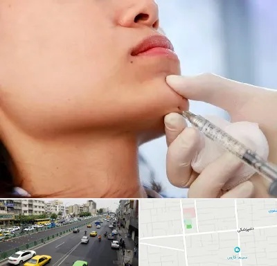 زاویه سازی صورت در خیابان دامپزشکی