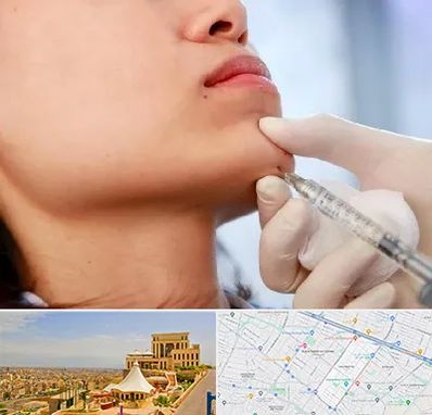 زاویه سازی صورت در هاشمیه مشهد 