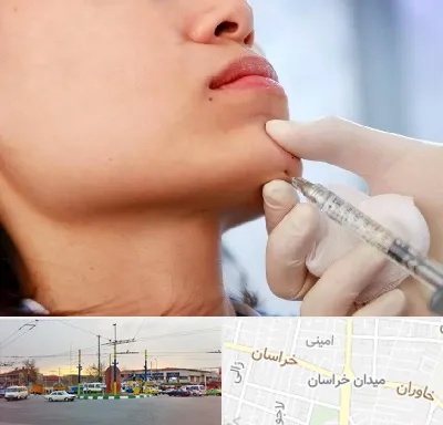 زاویه سازی صورت در میدان خراسان