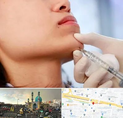 زاویه سازی صورت در رسالت 