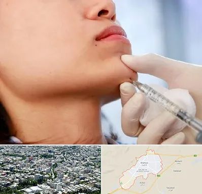 زاویه سازی صورت در شاهرود