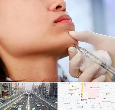 زاویه سازی صورت در توحید 