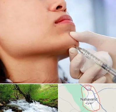 زاویه سازی صورت در نهاوند