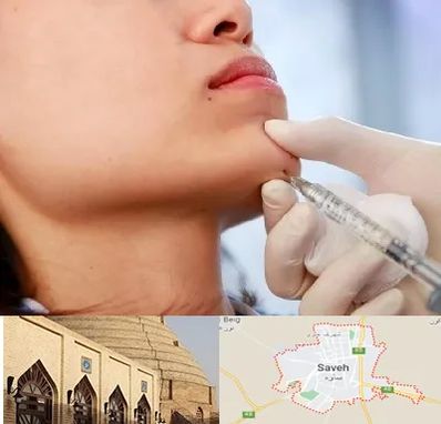 زاویه سازی صورت در ساوه