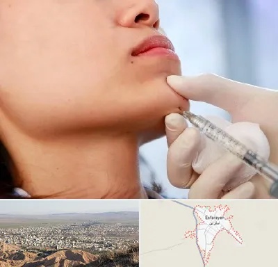 زاویه سازی صورت در اسفراین