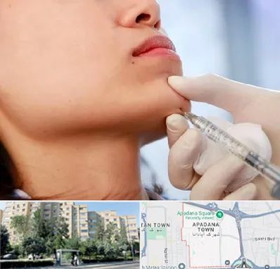 زاویه سازی صورت در آپادانا