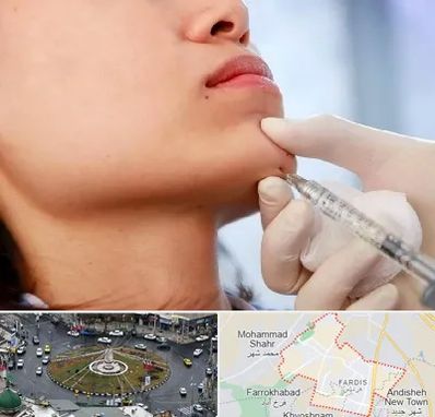 زاویه سازی صورت در فردیس کرج 