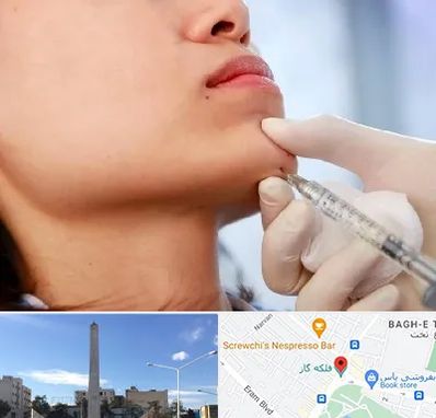 زاویه سازی صورت در فلکه گاز شیراز