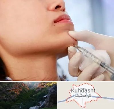 زاویه سازی صورت در کوهدشت