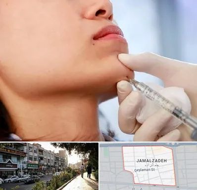 زاویه سازی صورت در خیابان جمالزاده