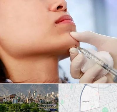 زاویه سازی صورت در جمشیدیه