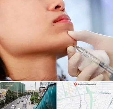 زاویه سازی صورت در بلوار فرحزادی