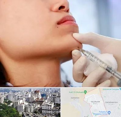 زاویه سازی صورت در ولنجک 