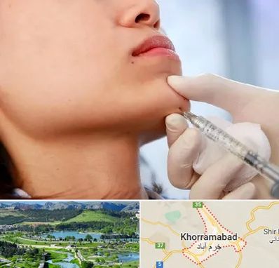 زاویه سازی صورت در خرم آباد