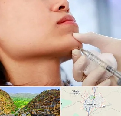 زاویه سازی صورت در کامیاران