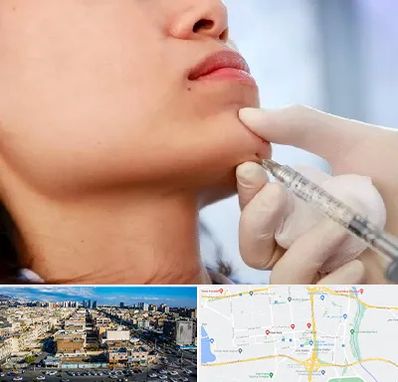 زاویه سازی صورت در شهرک راه آهن 