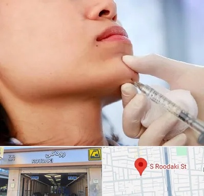 زاویه سازی صورت در رودکی