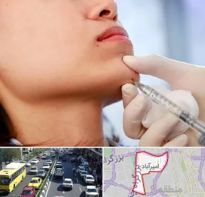 زاویه سازی صورت در امیرآباد