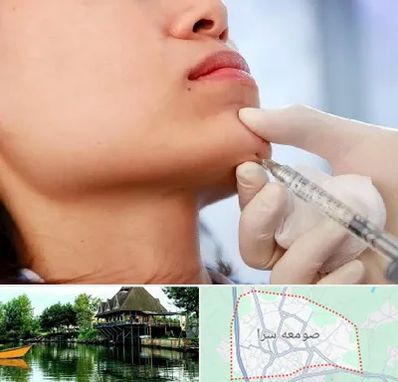 زاویه سازی صورت در صومعه سرا