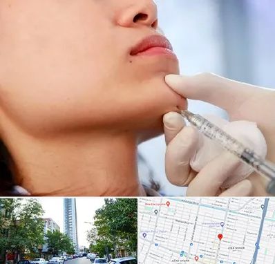 زاویه سازی صورت در امامت مشهد 