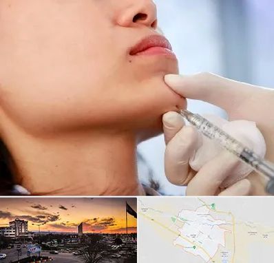 زاویه سازی صورت در قوچان