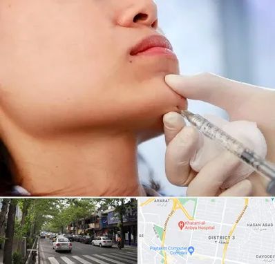 زاویه سازی صورت در ظفر 