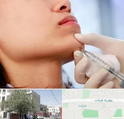 زاویه سازی صورت در طرشت