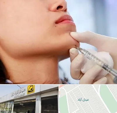 زاویه سازی صورت در عبدل آباد