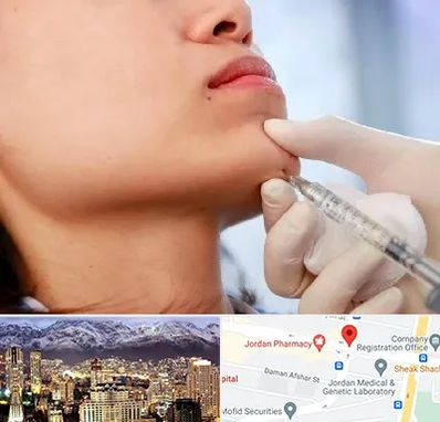 زاویه سازی صورت در جردن 